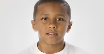 Otoplasty for Children NY