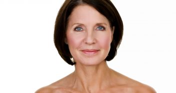 Older woman after facelift
