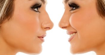 Before and After - young female