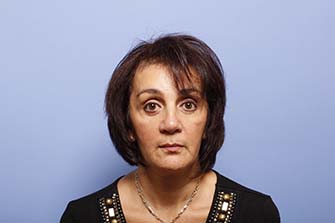 close up headshot of woman after facial implant