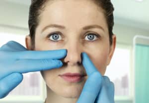 Revision Rhinoplasty