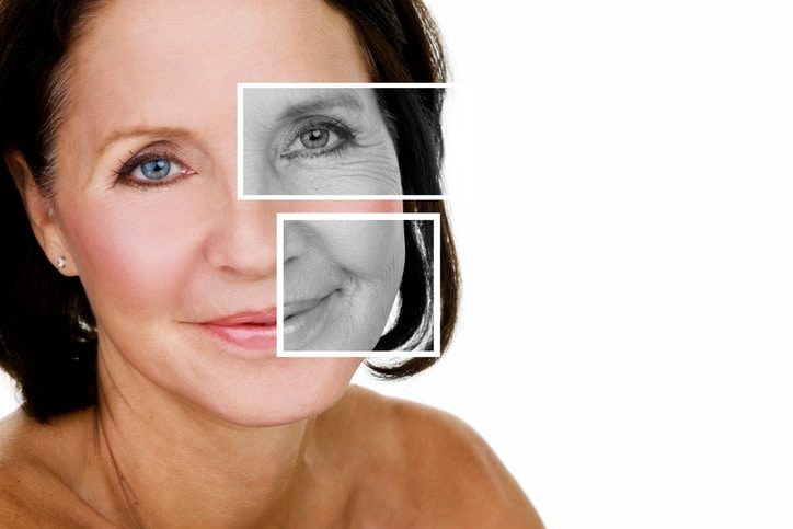 Facelift Surgery NYC